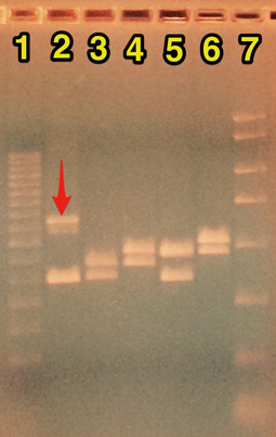 Sample agarose gel for DRD4-VNTR 